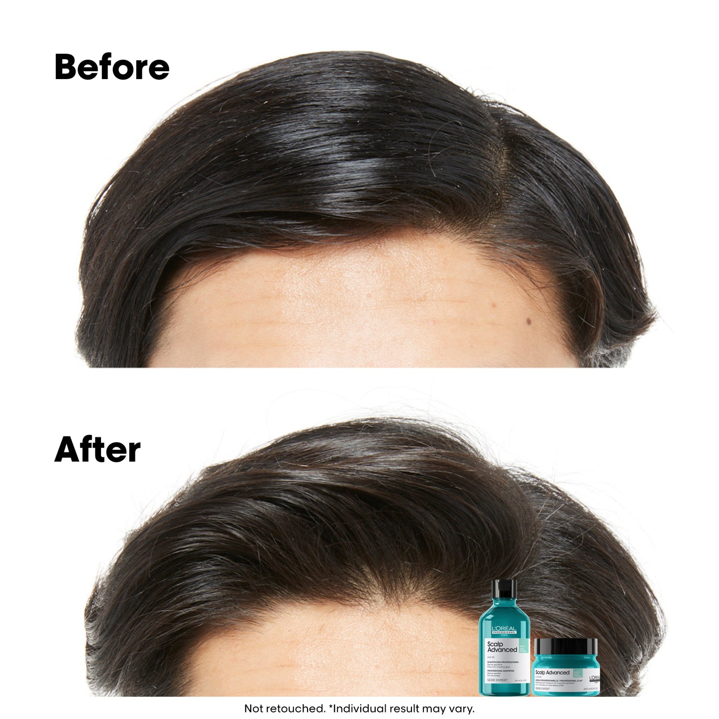 scalp advance - anti-oiliness dermo-purifier shampoo - (300 ml)