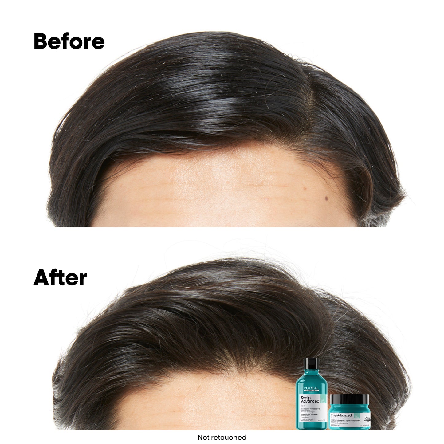 scalp advanced anti-oiliness 2-in-1 shampoo & masque - 250 ml