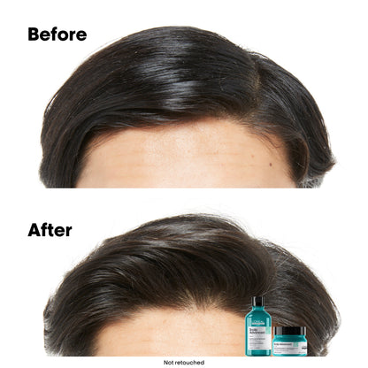 Scalp Advanced Anti-Oiliness 2-In-1 Shampoo & Masque - 250 ml