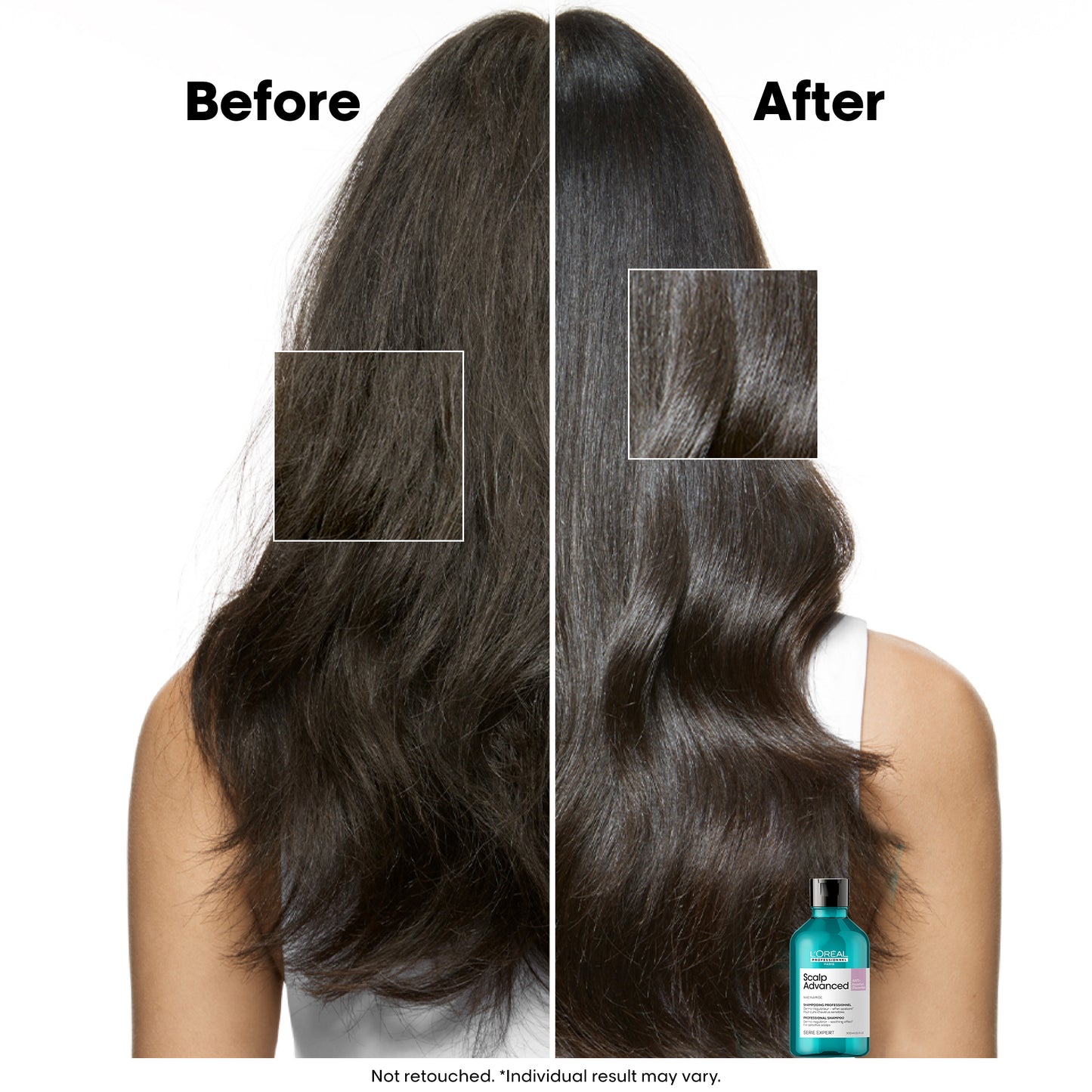 scalp advanced anti-discomfort dermo-regulator shampoo - 300 ml