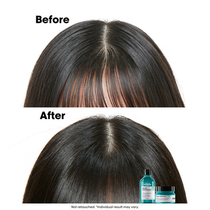 Scalp Advance - Anti-oiliness Dermo-Purifier Shampoo - (300 ml)