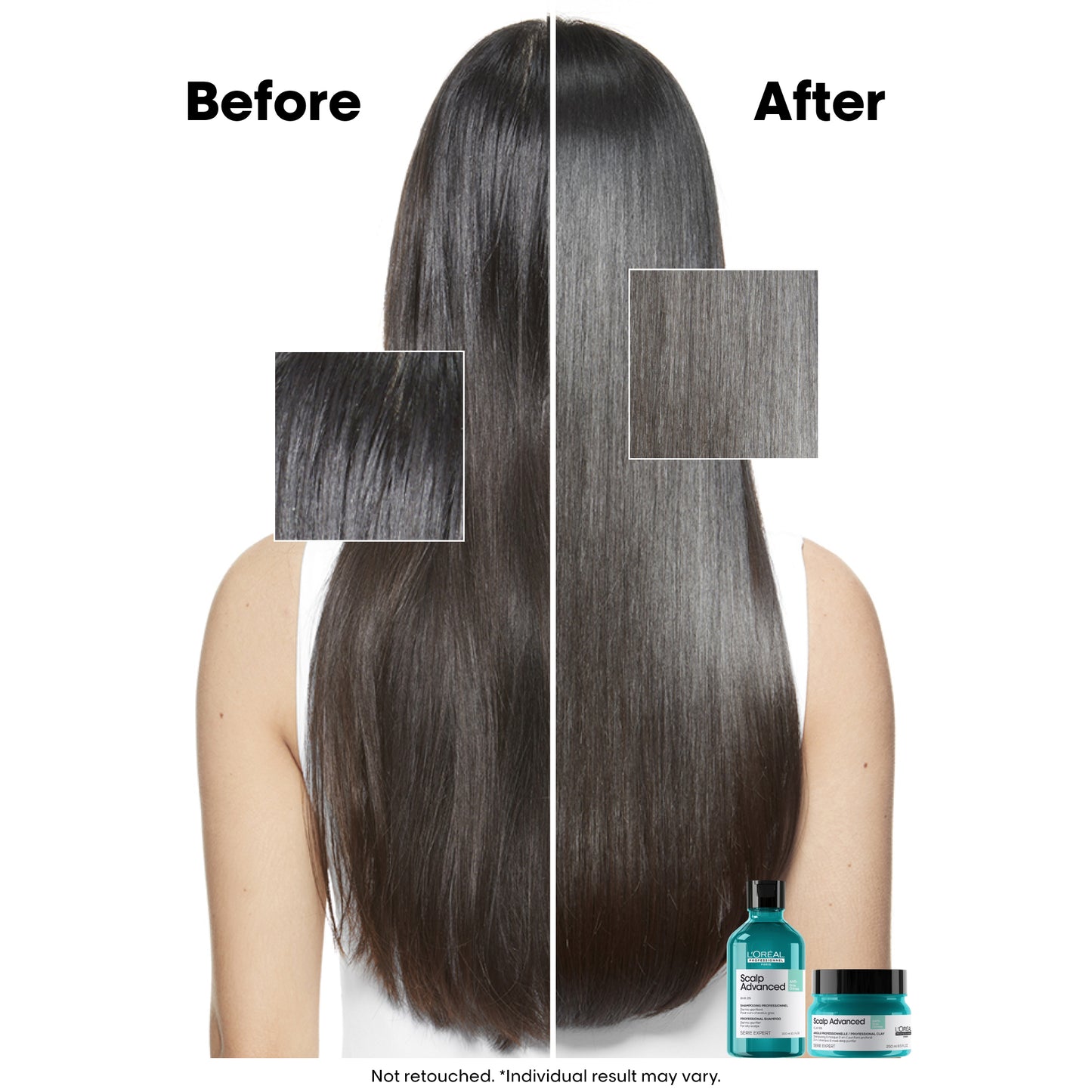 scalp advance - anti-oiliness dermo-purifier shampoo - (300 ml)