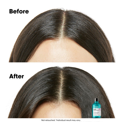 Scalp Advanced Anti-Discomfort Dermo-Regulator Shampoo - 300 ml