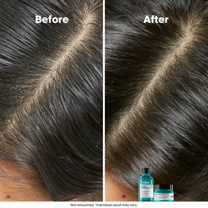 Scalp Advanced Anti-Oiliness 2-In-1 Shampoo & Masque - 250 ml