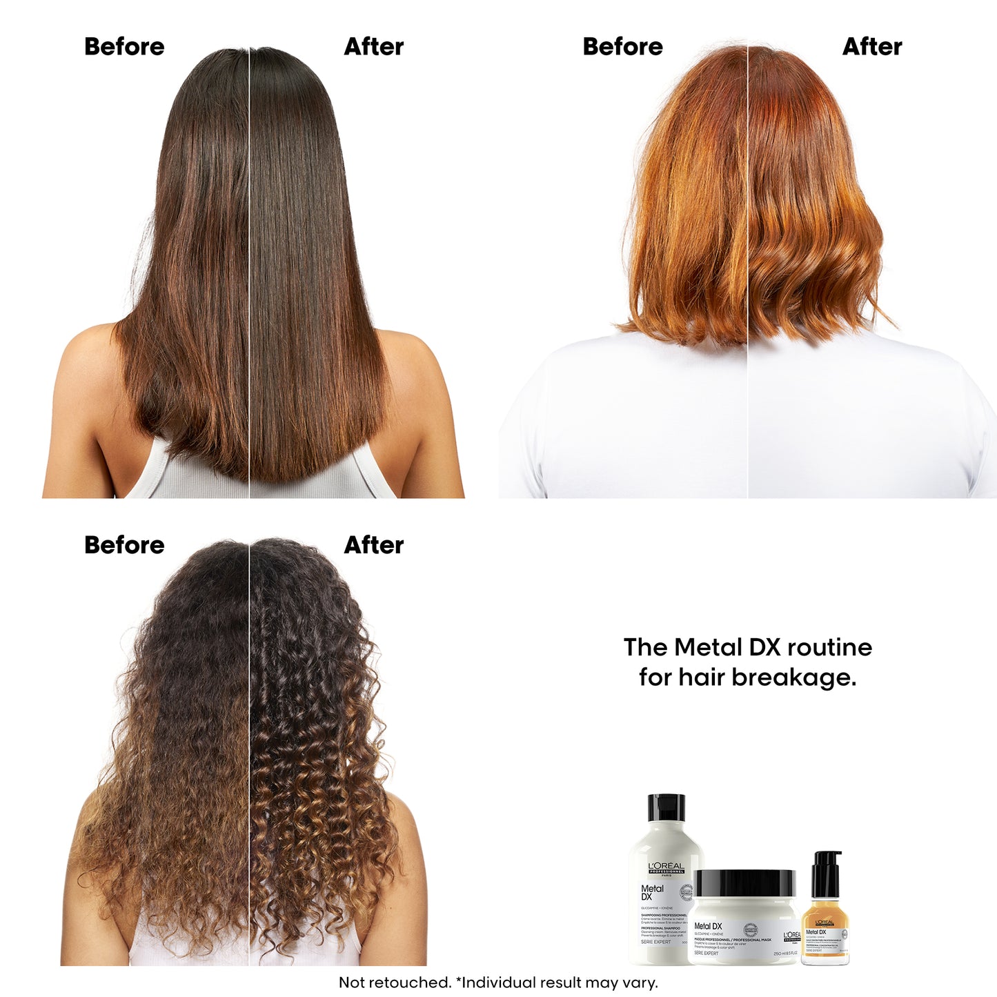 metal dx concentrated oil (leave-in serum) for hair breakage - 50ml